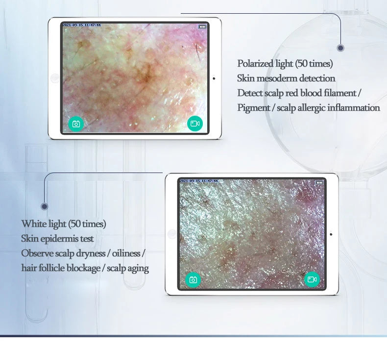 New WIFI HD 5G Scalp/Skin /Hair Follicle Detector Professional 50X/200X Skin Analyzer Rechargeable UV Testing Analysis Magnifier
