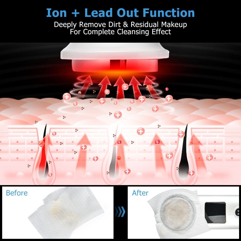 Cleansing Rejuvenation Device LED Photon Therapy Vibration Massager Skin Beauty Instrument Warm Treatment Massage Face Care Tool