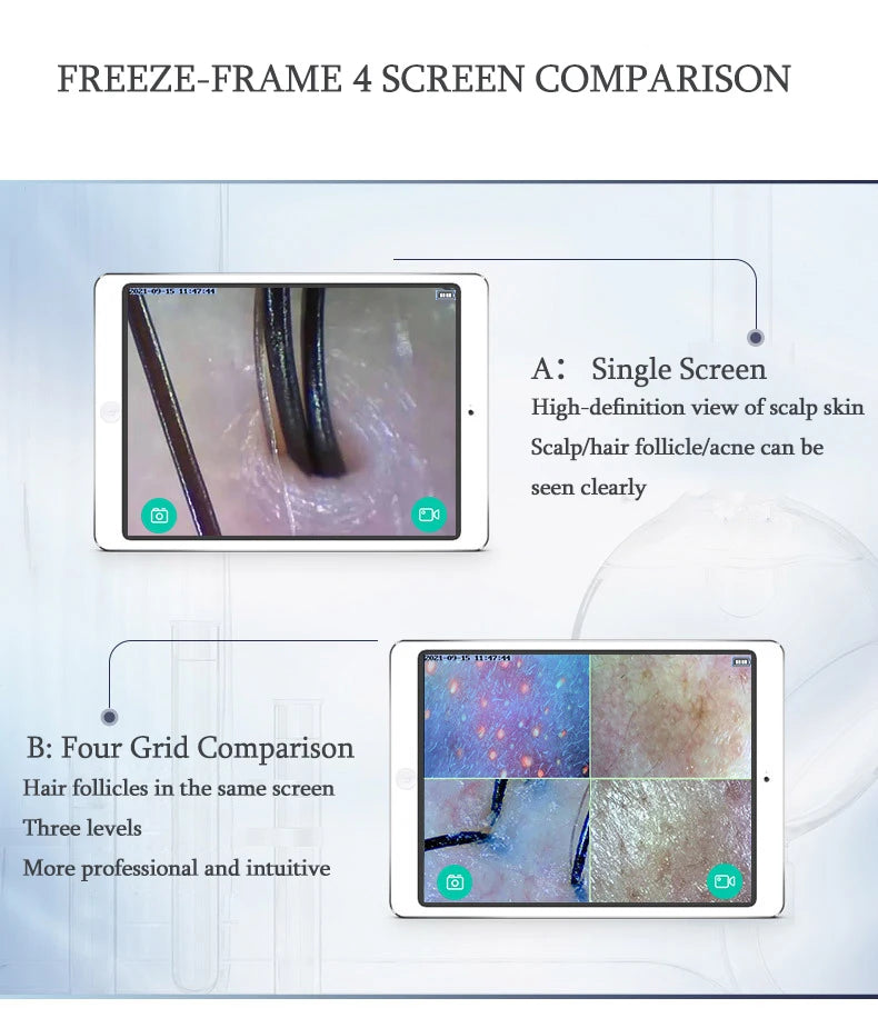 New WIFI HD 5G Scalp/Skin /Hair Follicle Detector Professional 50X/200X Skin Analyzer Rechargeable UV Testing Analysis Magnifier