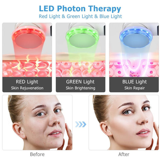 Cleansing Rejuvenation Device LED Photon Therapy Vibration Massager Skin Beauty Instrument Warm Treatment Massage Face Care Tool